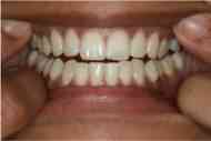 Smile photo guide