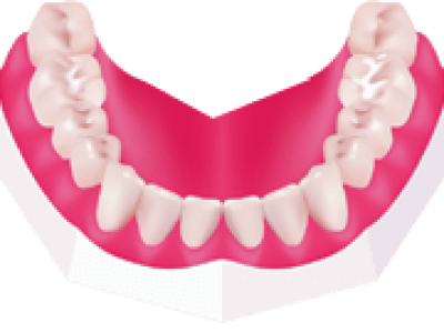 Fissure_Sealants-copy