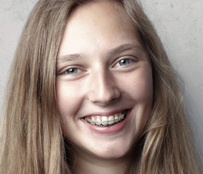 braces-pexels-andrea-piacquadio-3812720