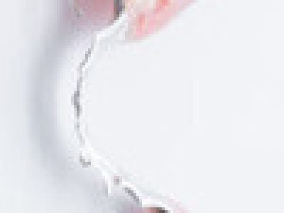 denture-1