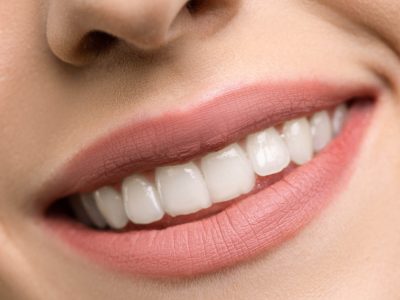 healthy-teeth-pexels-photo-3762441