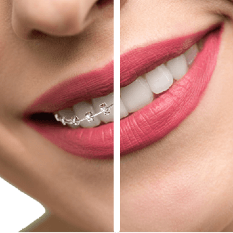 orthodontics-new-copy