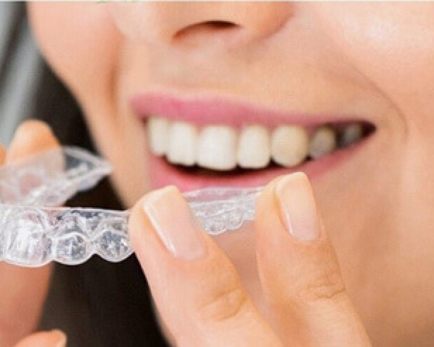 orthodontics-pexels-arvind-philomin-11887613