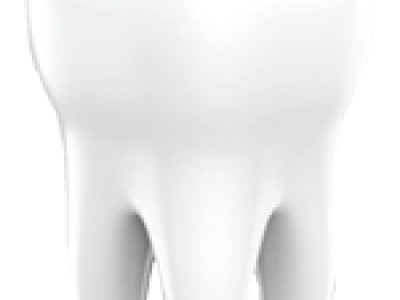 tooth-extraction-small-2